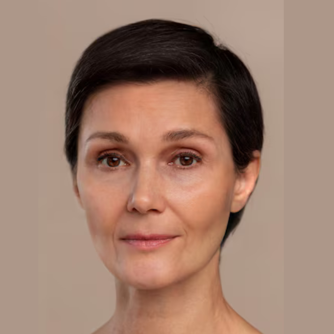 After Anti Wrinkle Treatment