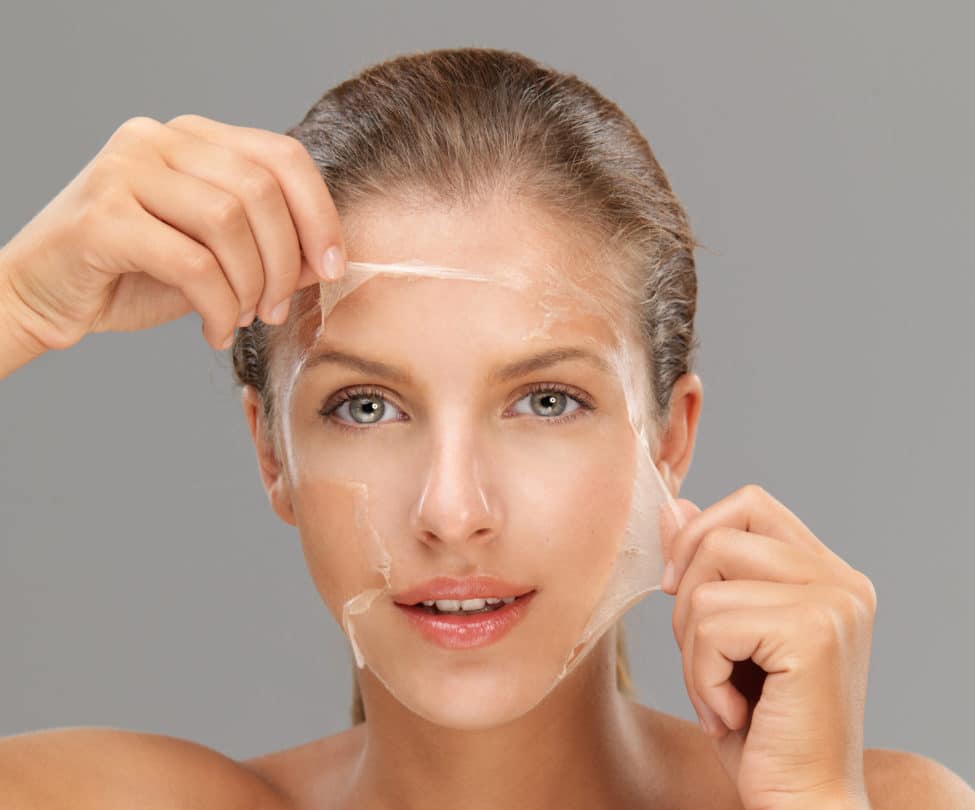 Deep Chemical Peel