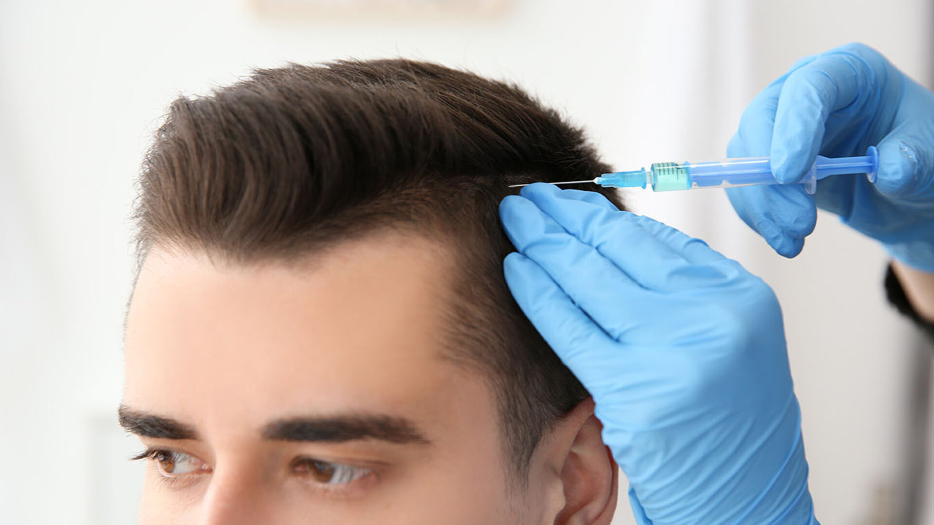Hair Mesotherapy in Delhi