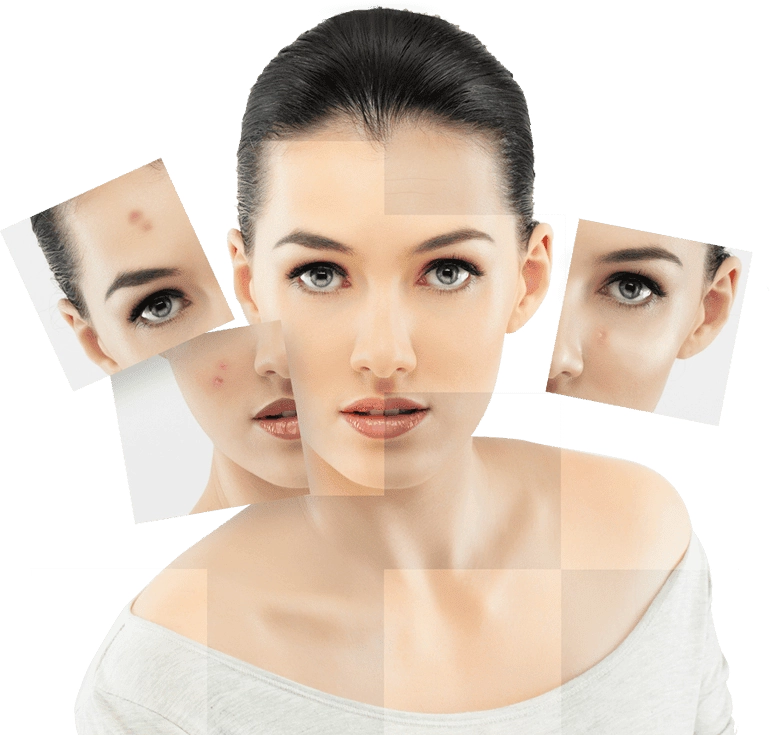 Laser Facial Process